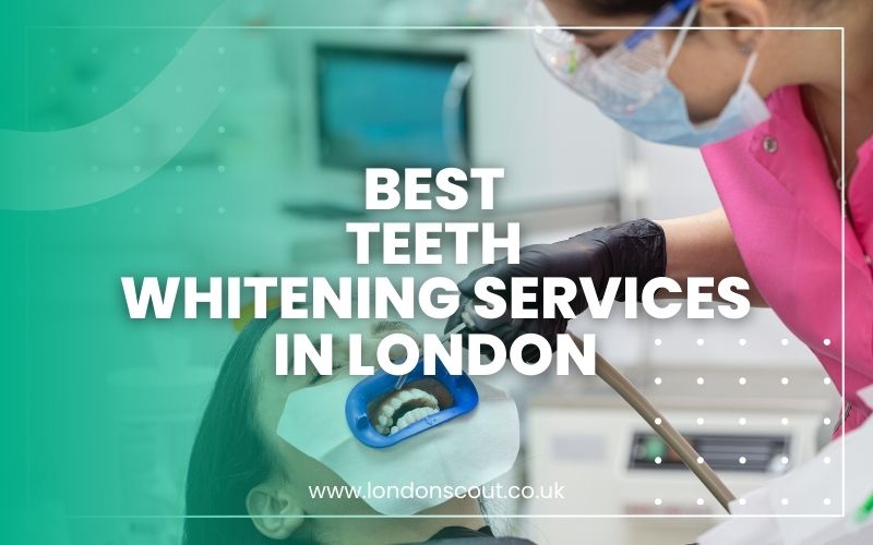 Best Teeth Whitening Services in London